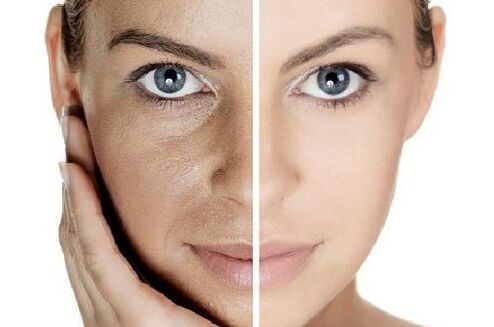 Hacer la piel con su propio plasma sanguíneo