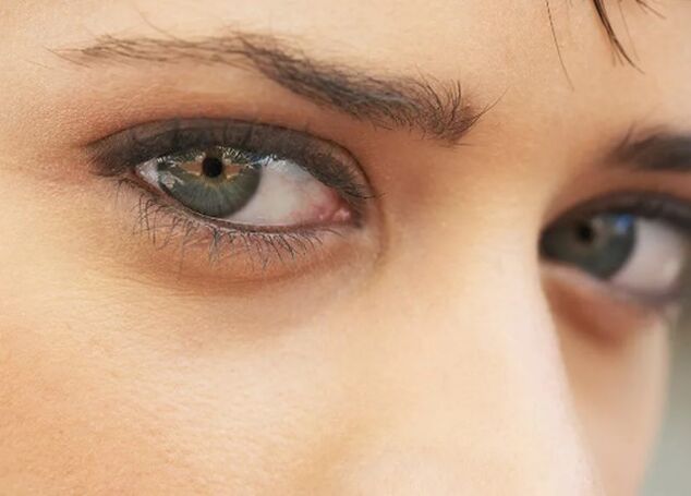Círculos oscuros debajo de los ojos