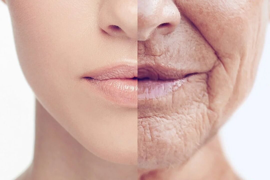 Deterioro de la piel con la edad.
