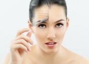 Chica después del rejuvenecimiento facial con láser fraccionado.