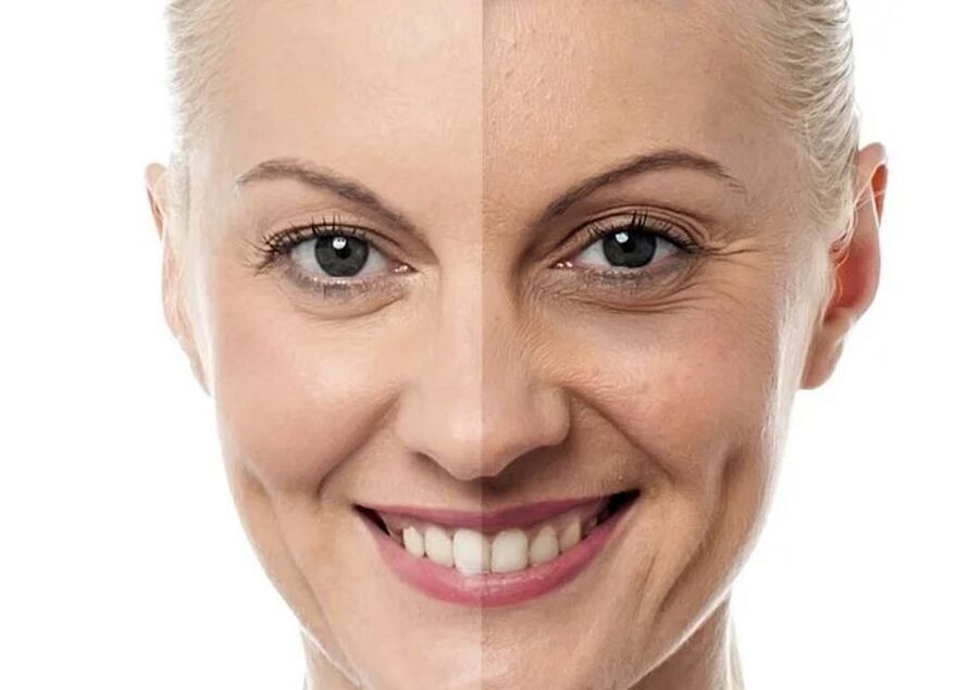 Los mejores tratamientos faciales cosméticos. 
